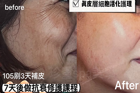 臉部項目10
